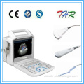 Portable Color Doppler Ultrasound Scanner (THR-CD003V)